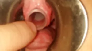 යුරෝපීය බබෙක් ප්‍රසිද්ධියේ පහර දෙයි